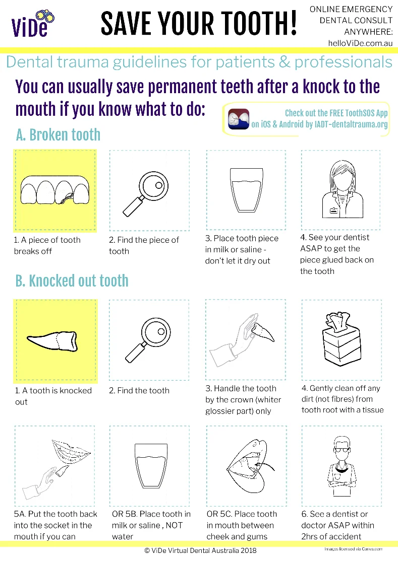 ViDe Save Your Tooth Screenshot.jpg