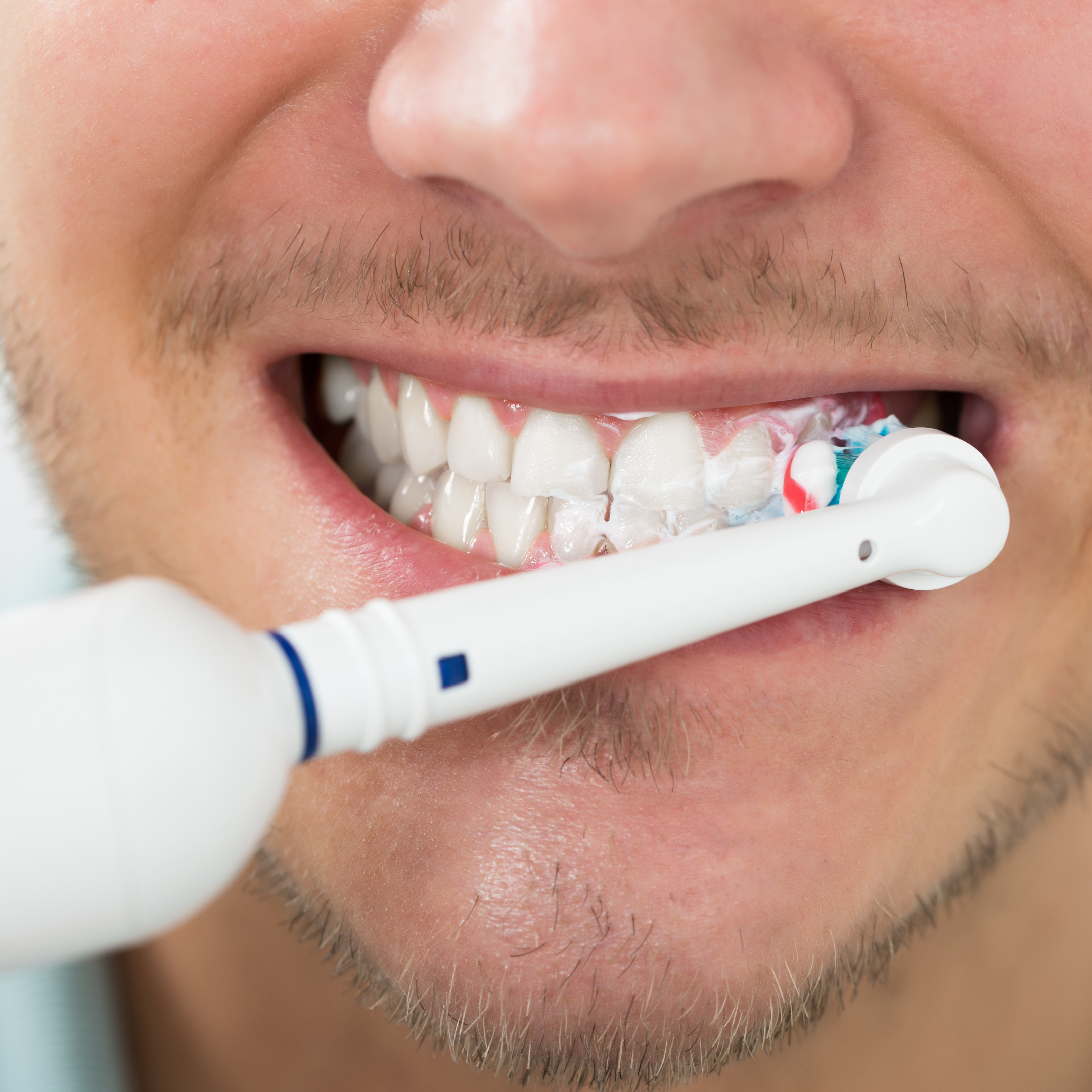 Top tips to avoid teeth sensitivity with an electric toothbrush
