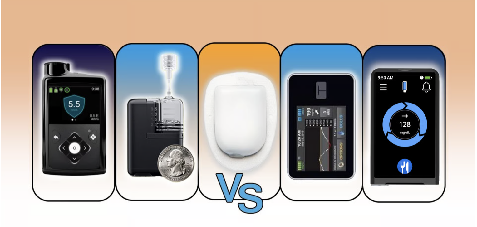 Automated Insulin Delivery Systems - A Practical Comparison Guide