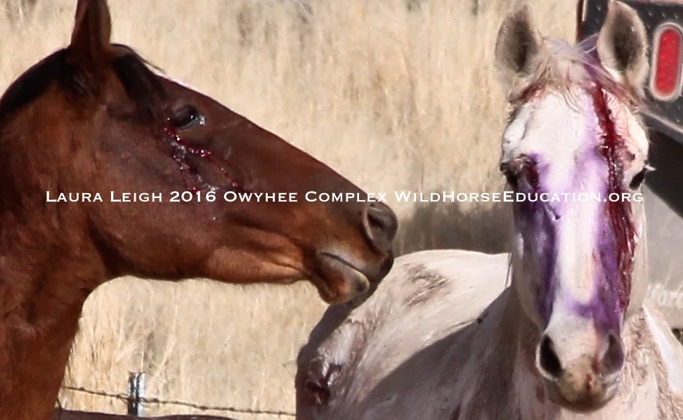 Injuries like these are preventable. You just need to care enough. 