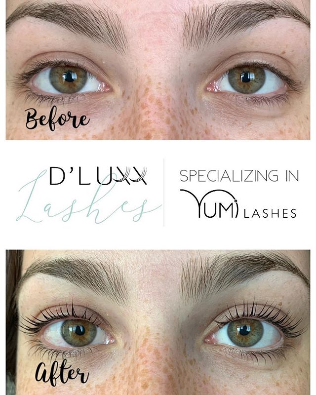 Don&rsquo;t fake it!
Give your lashes natural lift!
NO lash extension ⛔️
NO lash growth serum ⛔️
NO mascara used ⛔️
No Curler ⛔️
Cruelty Free ✅🐰
YUMILashes result are the most dramatic and long lasting, with absolutely NO harm to your natural lashes