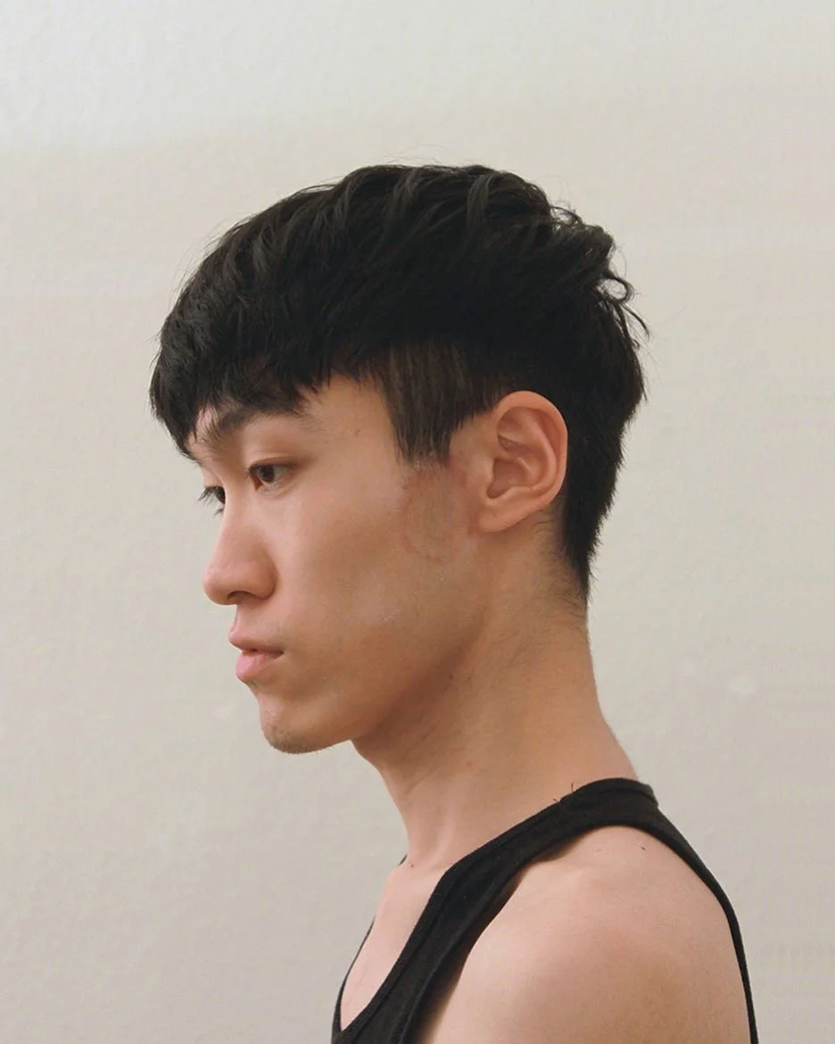 Self Portrait: The evening when I was beaten up by a stranger with a glass bottle, 2015