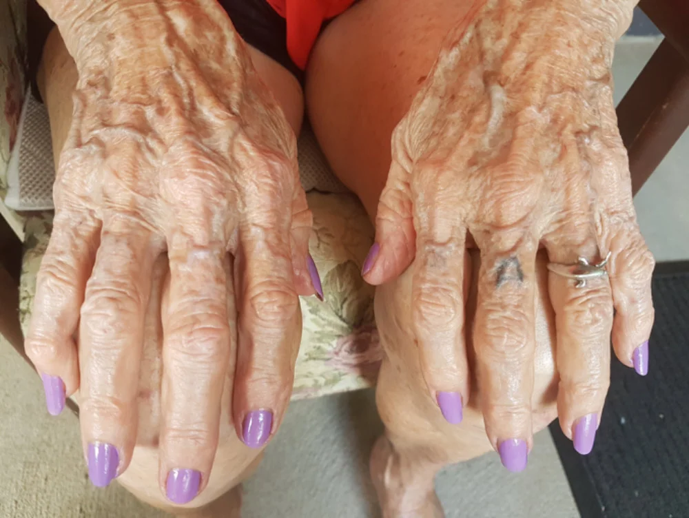 beryl-yourhands-yourstory.jpg