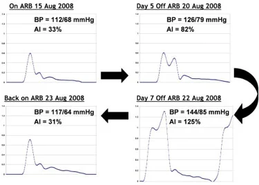 bpplus-effect-of-arb.jpg