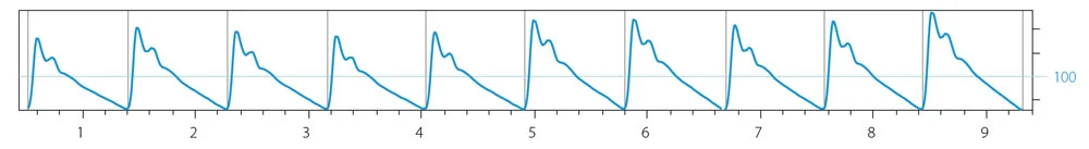 Rythm-strip.jpg