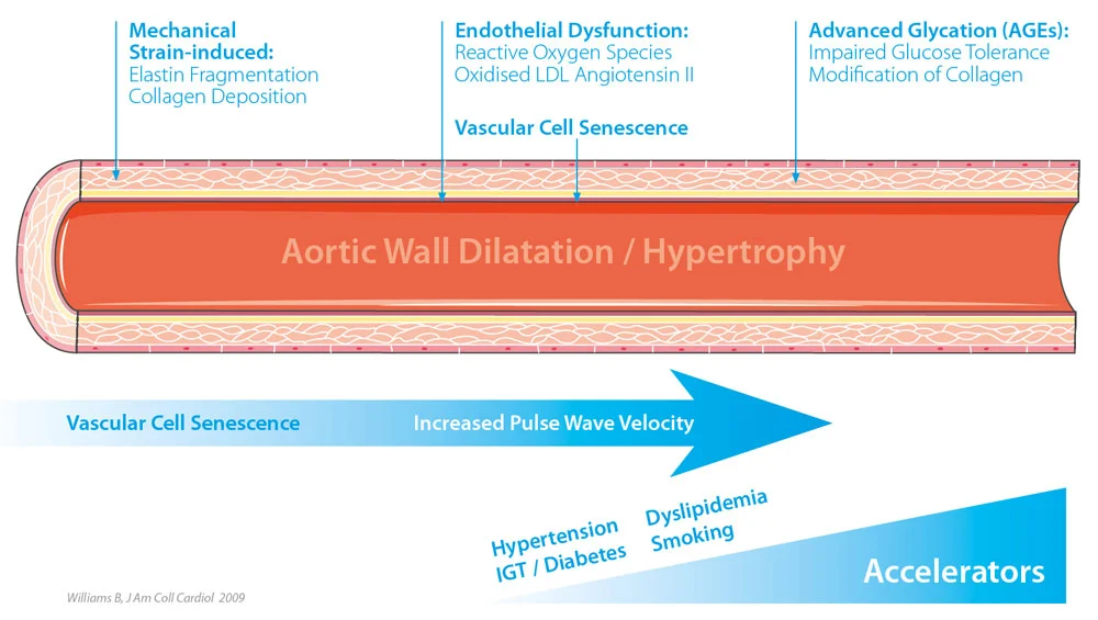 Arterial+Stiffness.jpg