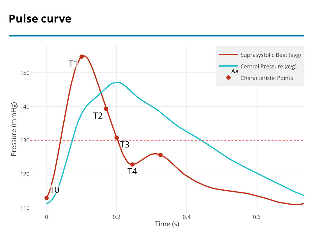 Pulse curve