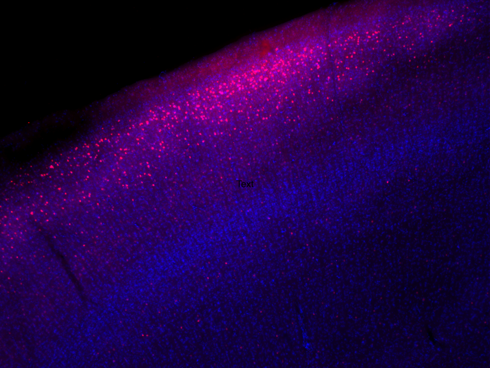 Trogdor_Calbindin-Cortex.png