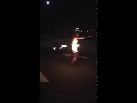 My first burn - Fire hooping (Copy)