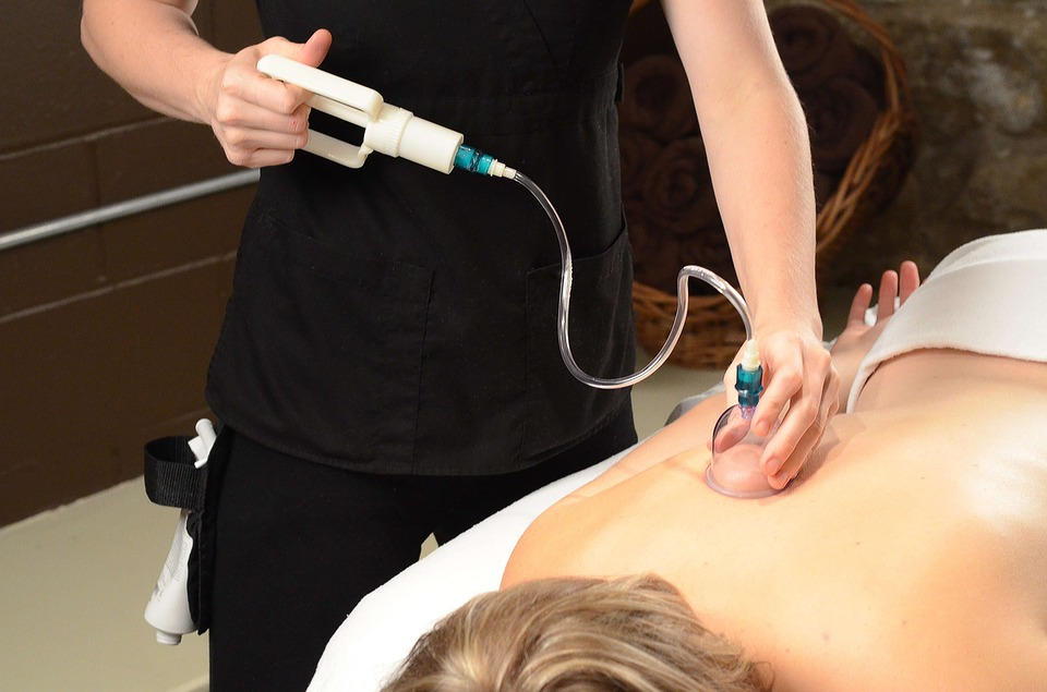 What Is Cupping Therapy and How Can This Practice Help You?