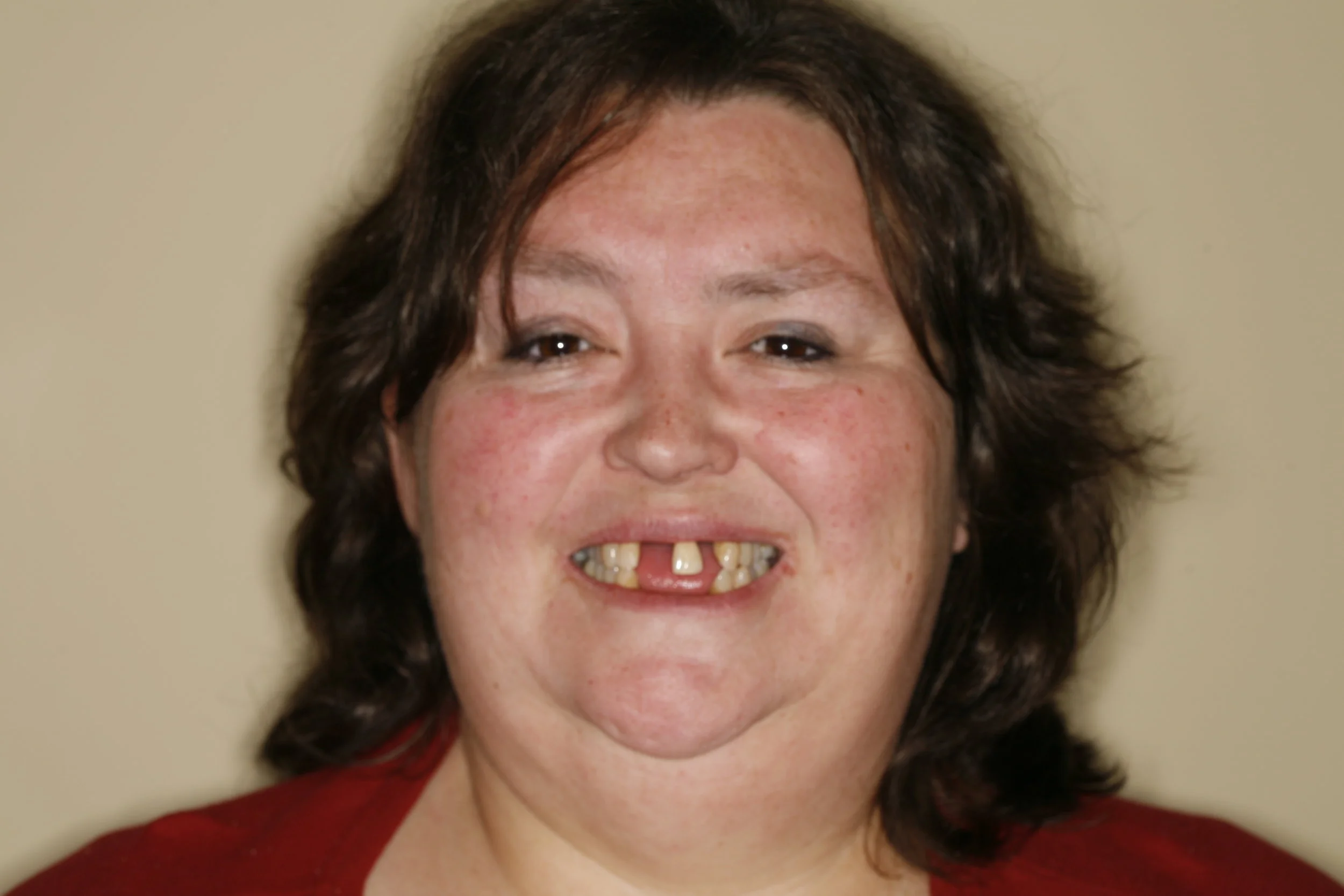 Leslie_before2.jpg