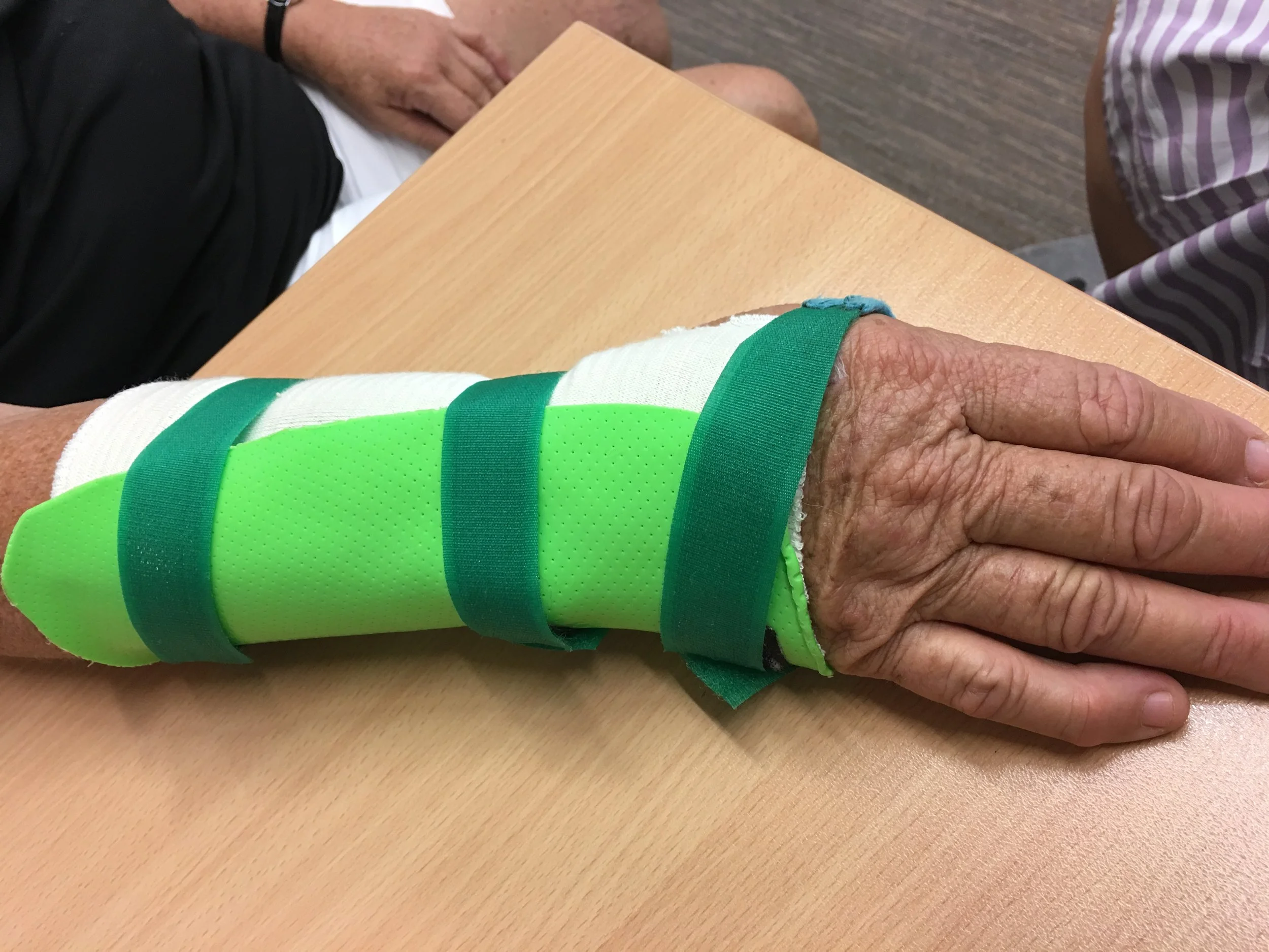 Ulnar Gutter Splint