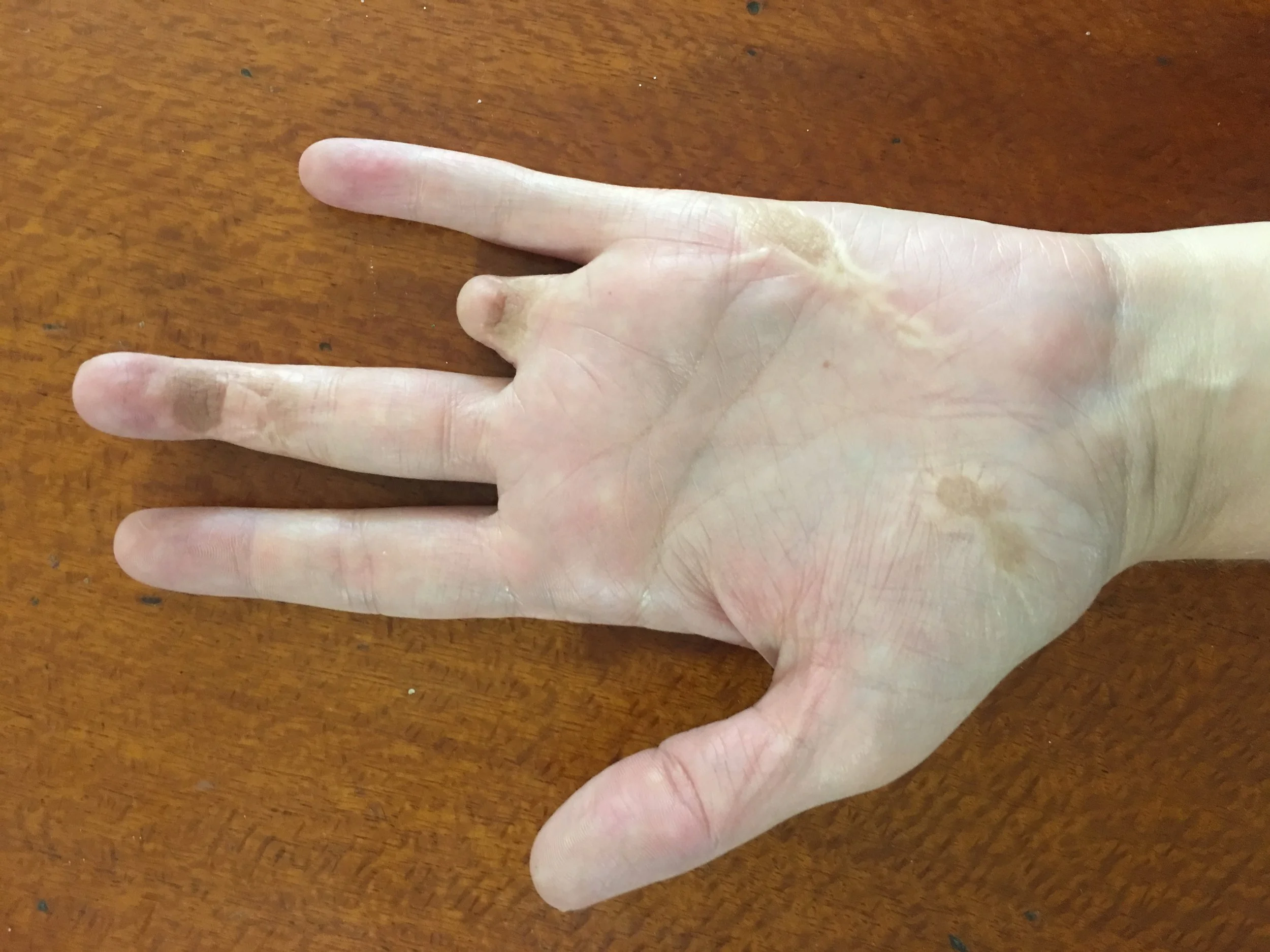 Hands: External Expression of Who We Are Inside | Advanced Health ...