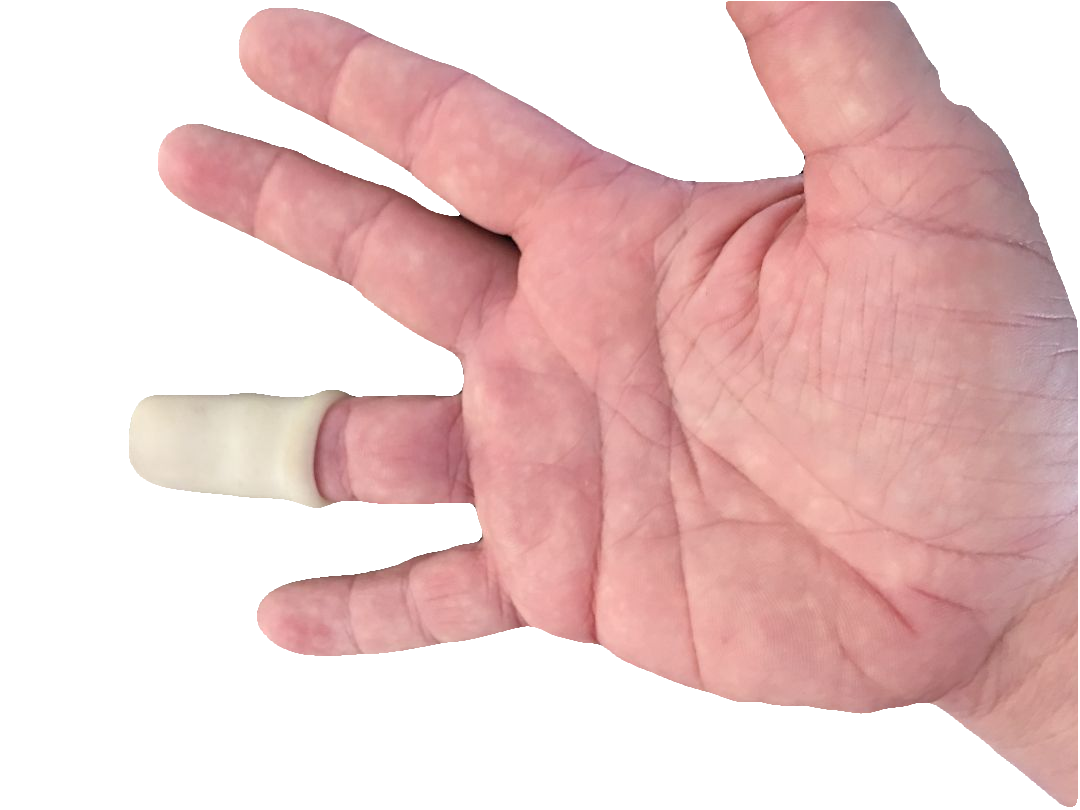 What is Tendinous Mallet Finger Advanced Health & Hand Therapy