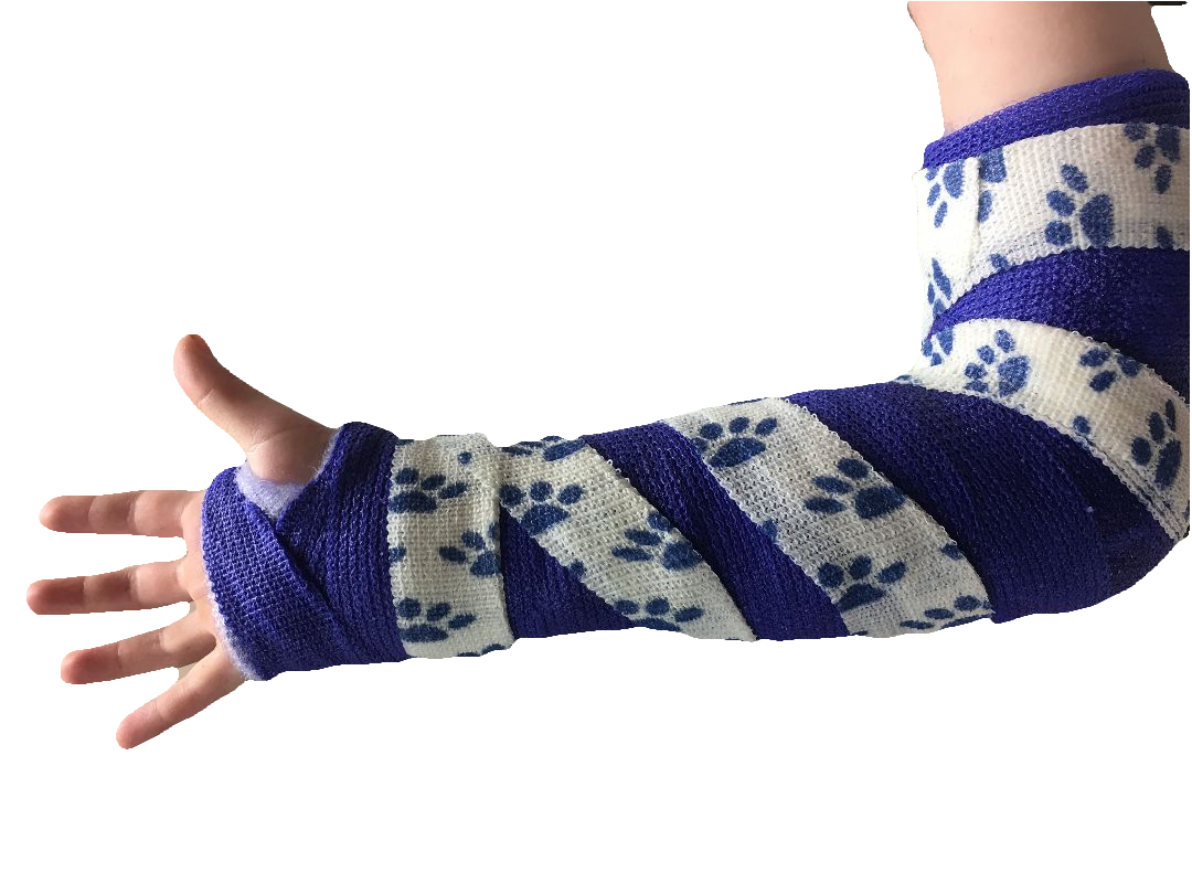 Casts come in all shapes & sizes, depending on the injury. Click here to view some different casts!