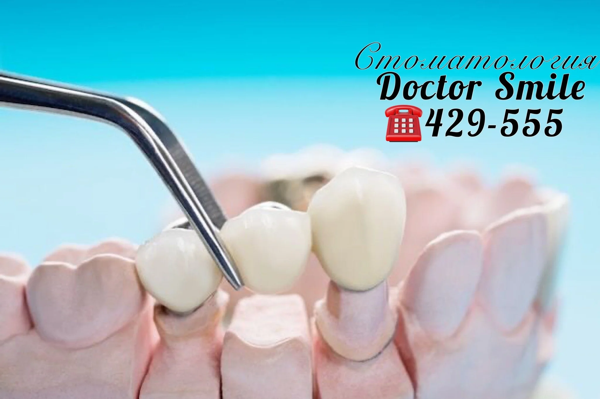 Протезирование зубов Тамбов — Доктор Смайл