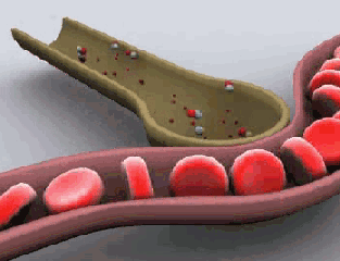 TC-Anatomy.gif