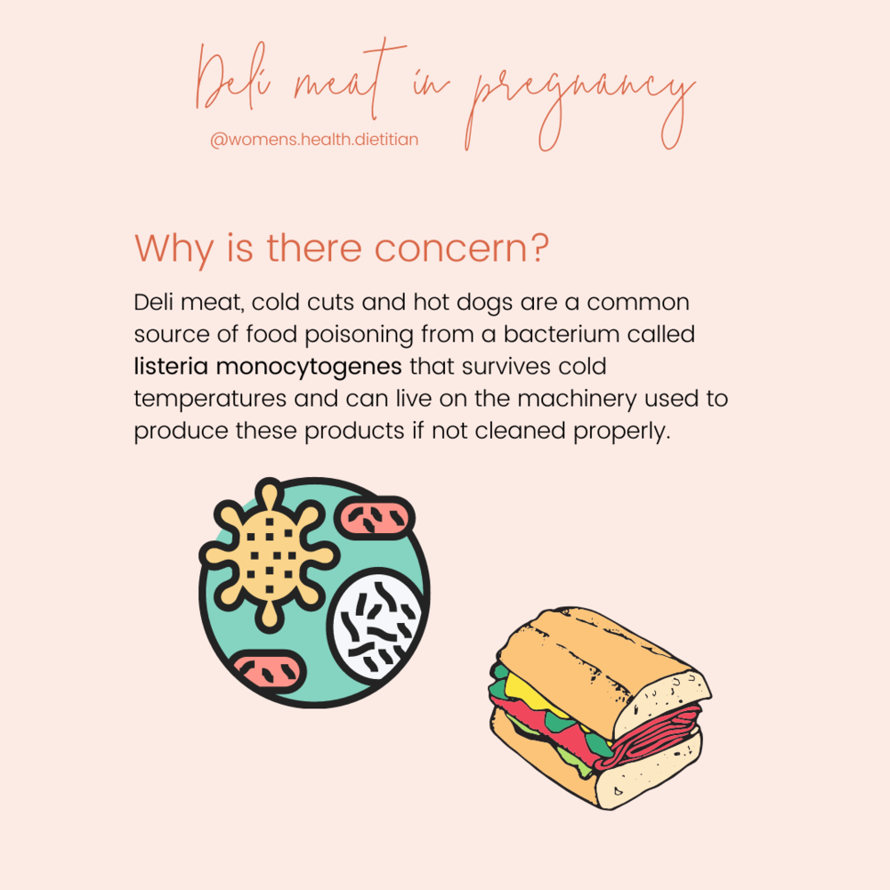 What's the with deli meat in pregnancy? — Dietitian - nutrition therapy for fertility & pregnancy