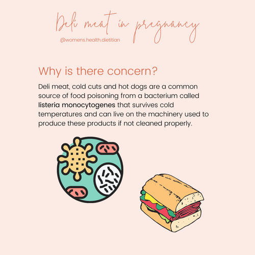 What's the deal with deli meat in pregnancy? — Dietitian nutritionists ...