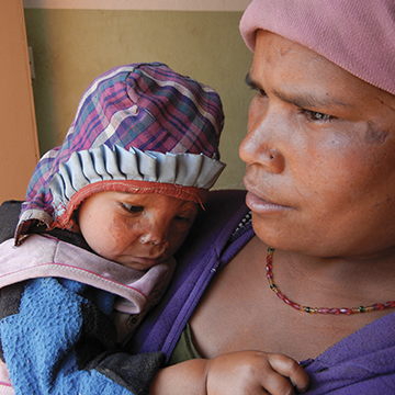   A villager and her child at NCBC for care  