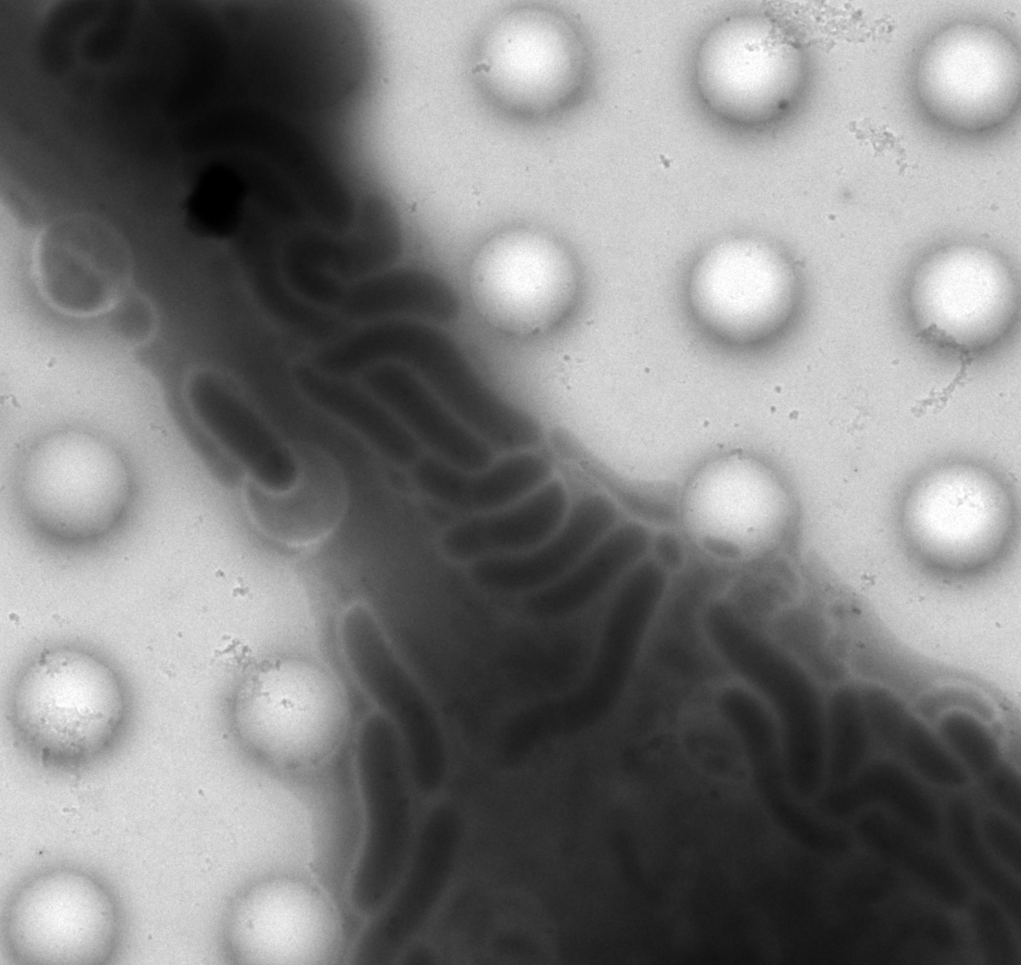 Hs746T_pylori_20130415_78.png