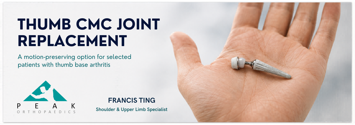 Thumb CMC joint replacement surgery performed for thumb arthritis by orthopaedic surgeon Francis Ting
