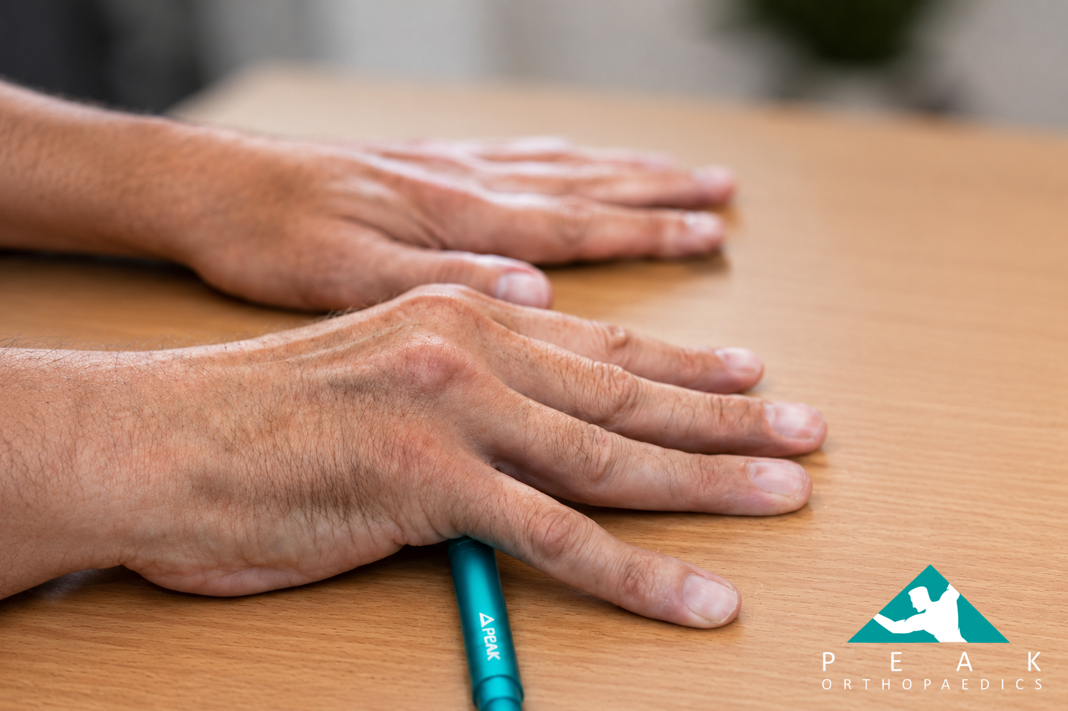 Dupuytren’s disease affecting the hand demonstrated with the tabletop test
