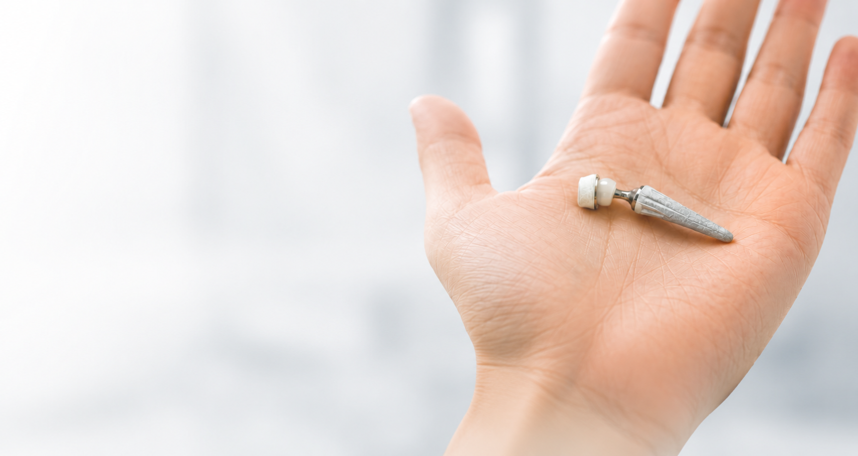 joint-replacement-thumb-implant-in-hand-banner.png