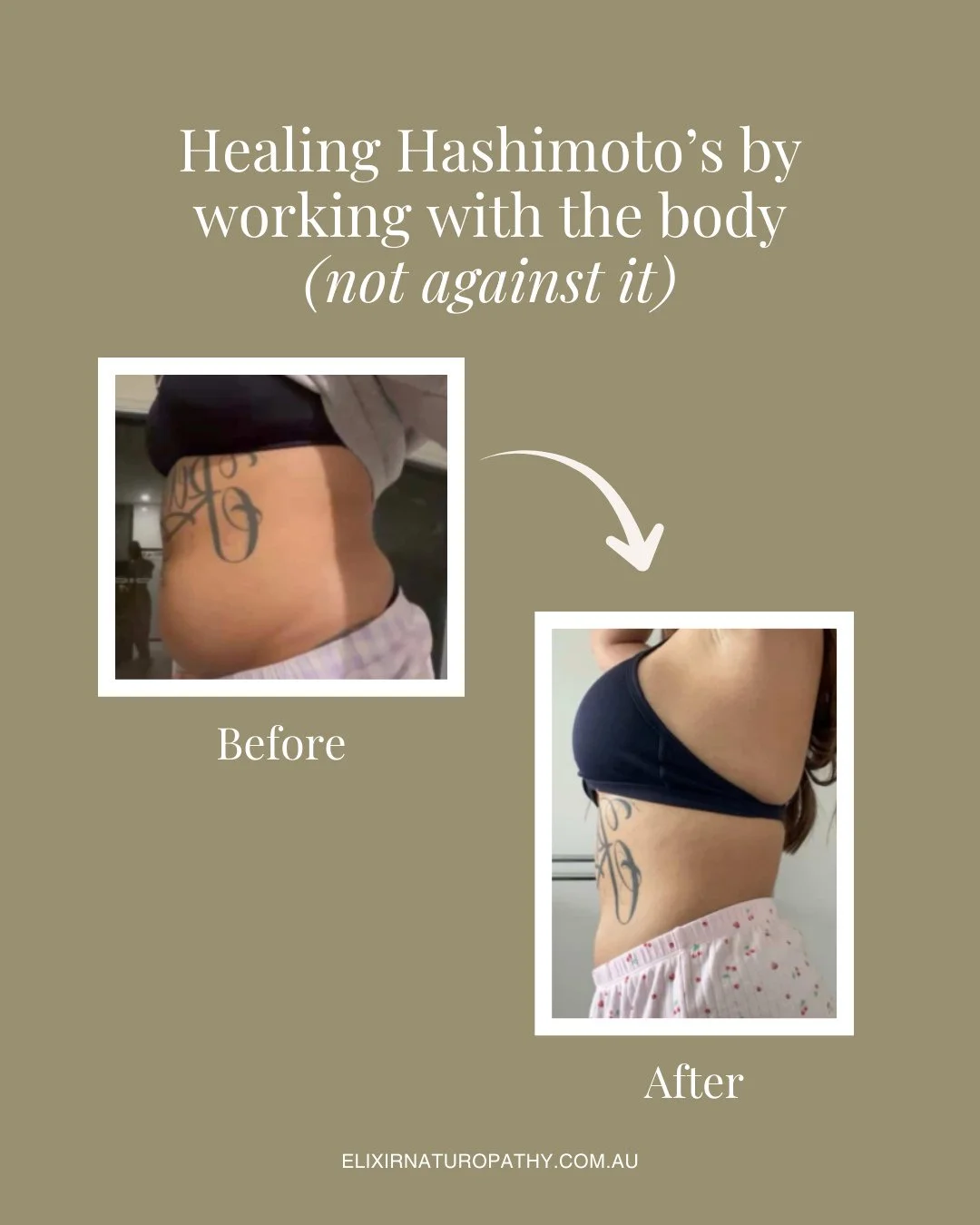 This is why I do what I do! These results are truly incredible...⁠
⁠
I&rsquo;ve been working with this beautiful client (shared with permission) to support her Hashimoto&rsquo;s symptoms, gut health, inflammation, nervous system, and relationship wit