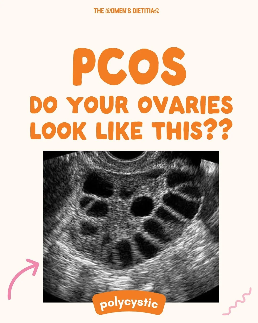 Help! My period is INSANE 🆘 

Maybe your ovaries are rockin&rsquo; pearls, maybe not. Regardless, if your period is less reliable than your ex, girl we need to talk. 📞 ➡️ 🫖 

I&rsquo;d love to help you get ovulation back on track, which translates
