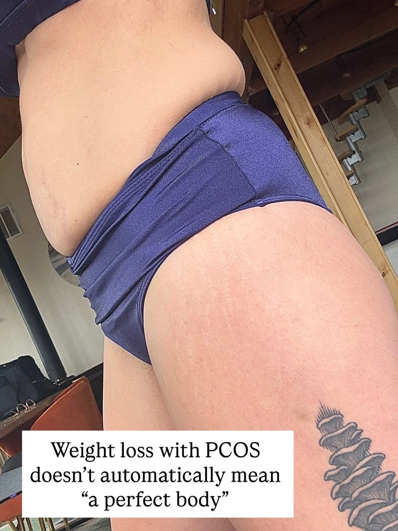 Your PCOS feed was looking really curated so thought I&rsquo;d pop in with a lil bit of reality 🩷🫶

IB: @tori_the_therapist 

#pcos #pcosweightloss #pcospregnancy #pcoscysters