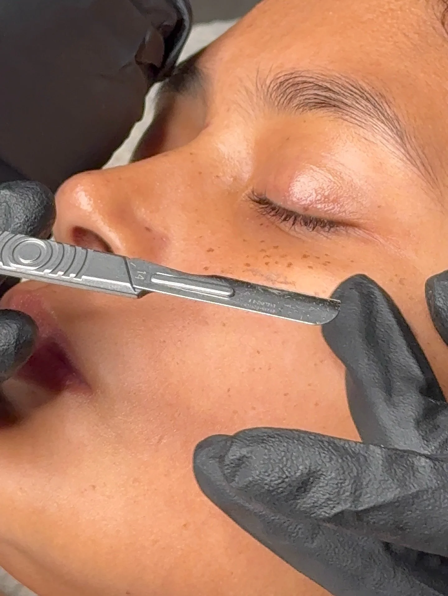 Dermaplane with us 🖤