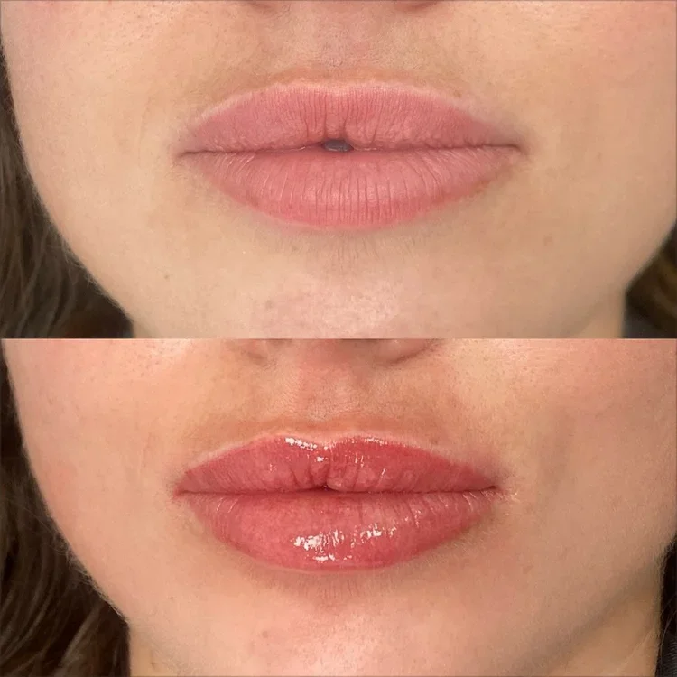 why winter is the perfect time for lip blush