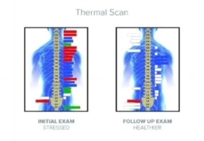 Thermal Scan.jpg