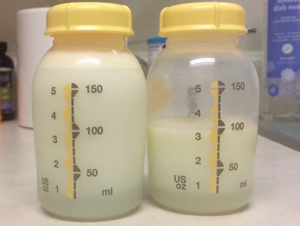 CMPA or lactose overload (foremilk/hindmilk imbalance)** (with pics) -  November 2020 Babies, Forums