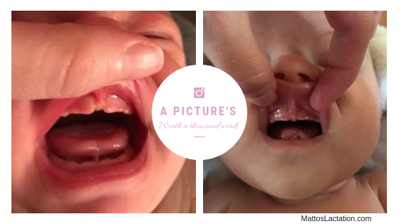 Oral Ties: A Pic is Worth 1000 Words