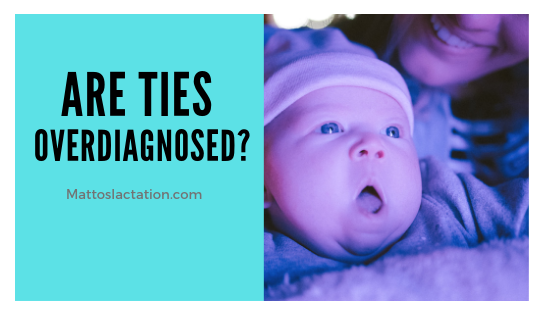 Re: Are We Overdiagnosing Tongue-Tie In Breastfeeding Newborns? | My response