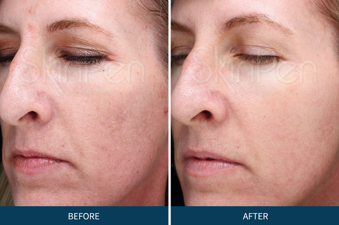 Screen Shot 2018-08-19 at 3.41.36 PM.png