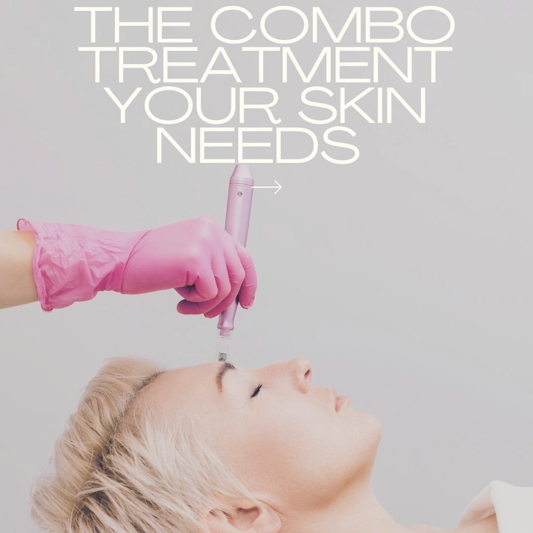 Next Level Pigment Fighting = Microneedling + VIPeel

Microneedling is excellent at breaking up sun damage and dark spots

VI Peel is the #1 choice for LIFTING the pigmentation from the skin, revealing a fresh, even glow.

When combined (2-4 weeks ap