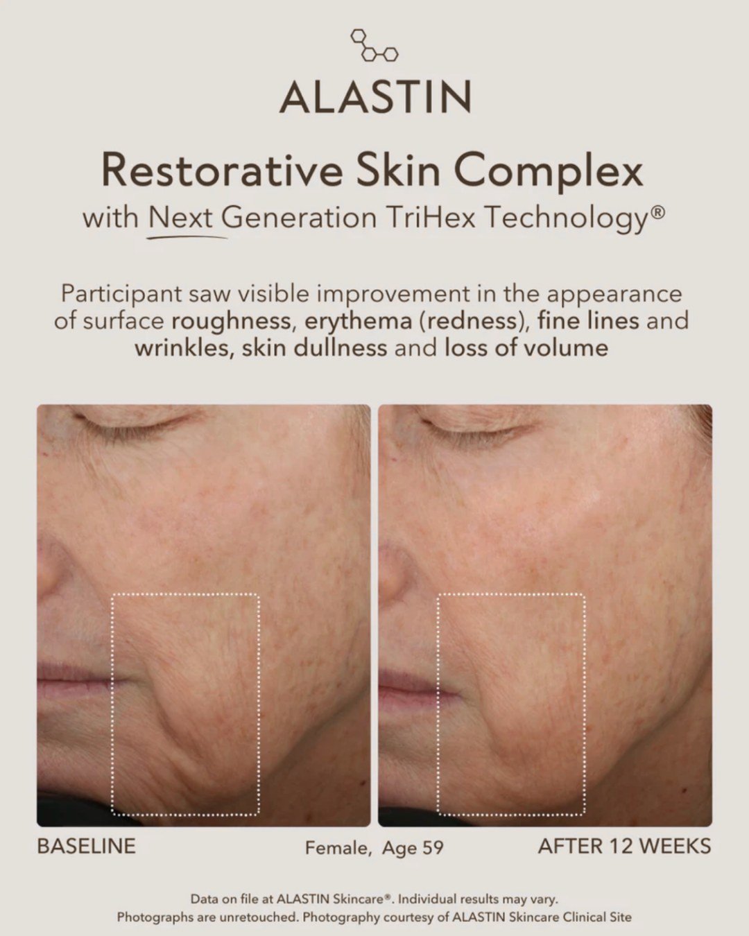 Real results backed by science ✨🧬🔬

Most people don&rsquo;t realize it, but about 80% of your results come from what you do at home, and only 20% from in-office treatments. Treatments help, but your daily routine is what truly transforms your skin.