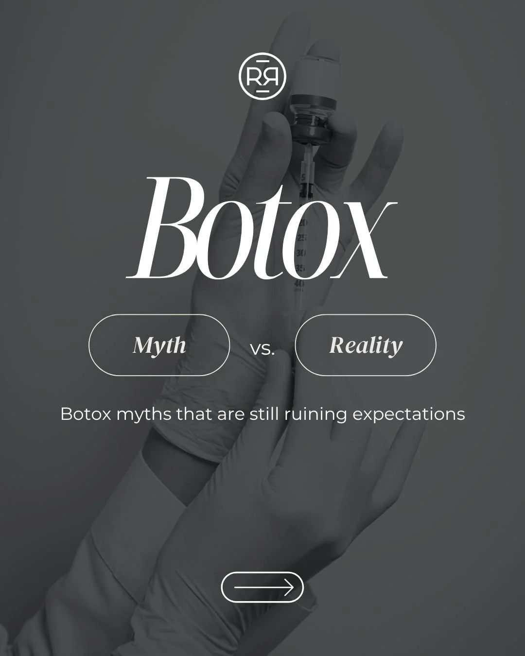 The fear around Botox usually comes from seeing bad or overdone results online.

Natural-looking Botox is less about freezing the face and more about softening tension while preserving movement.

The difference is technique, anatomy, and restraint.

