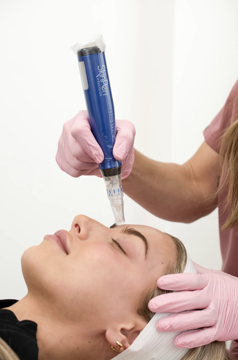 Microneedling in Denver: Everything You Need to Know Before Your First Treatment