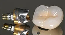 implant.jpg