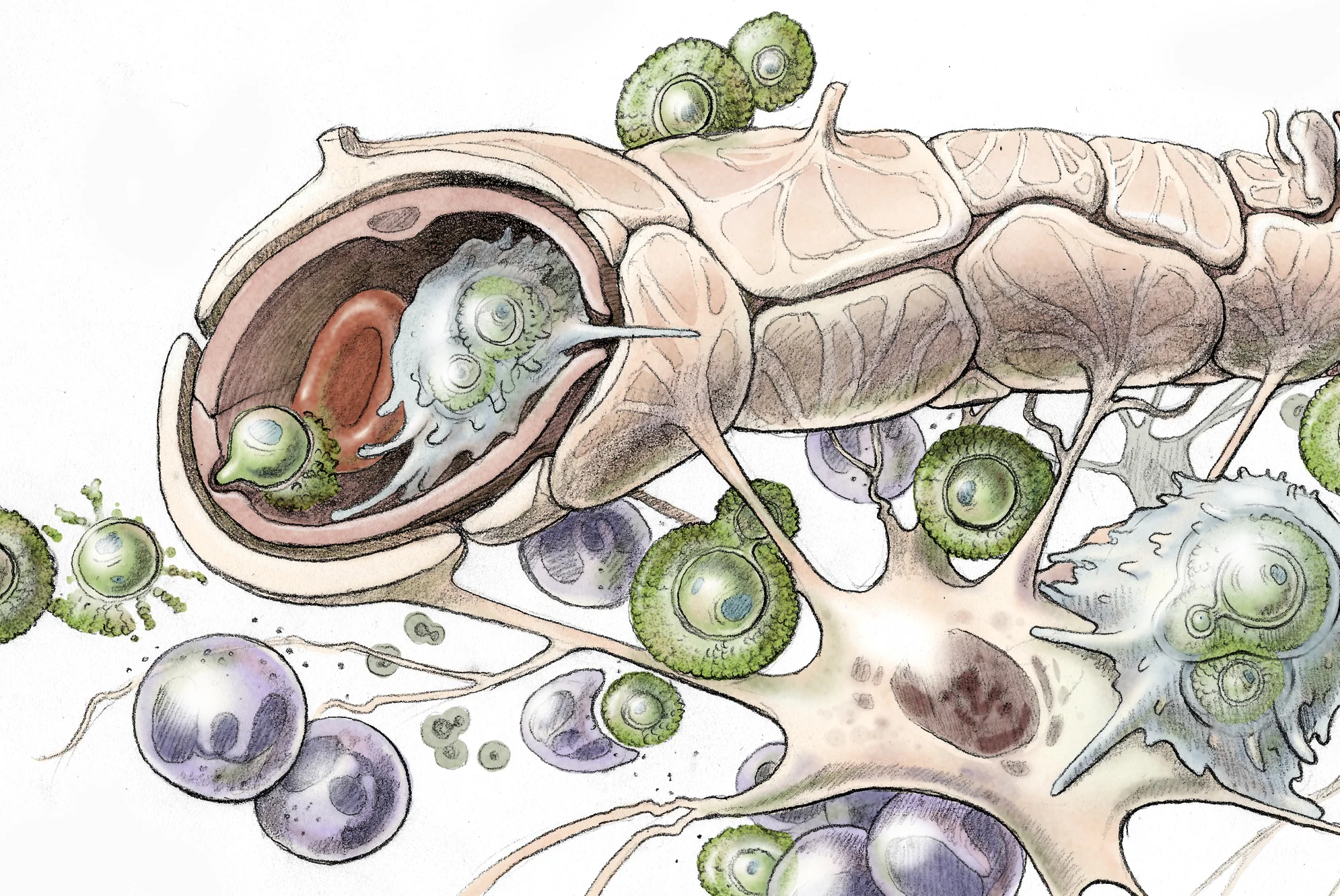Gauthier_meningo_BreachingTheBloodBrainBarrier_300dpi.jpg
