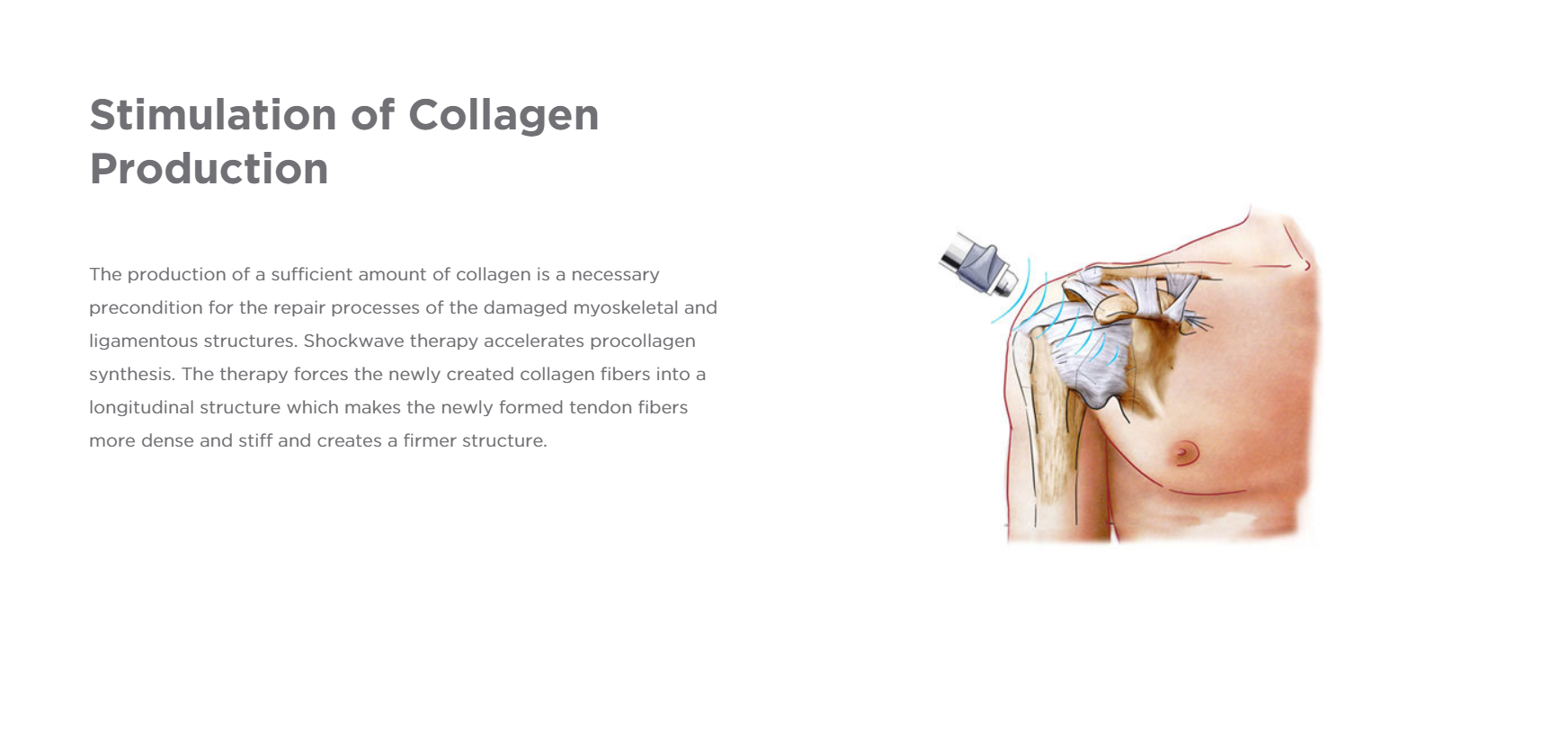 Collagen Production.PNG