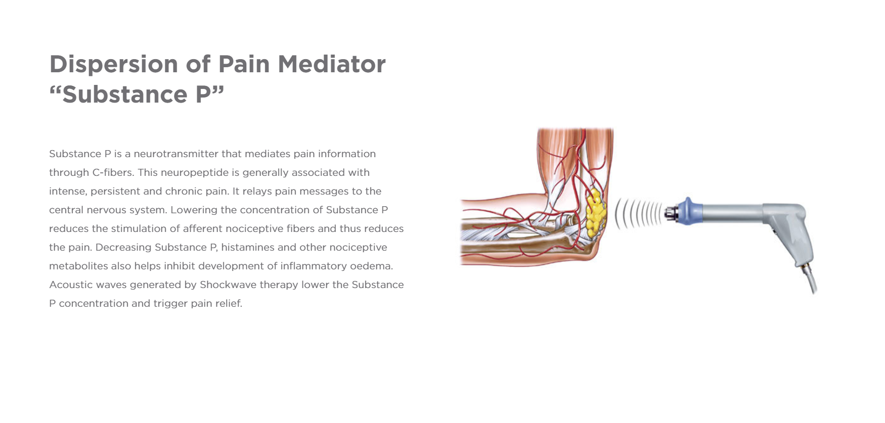 Pain Mediator.PNG