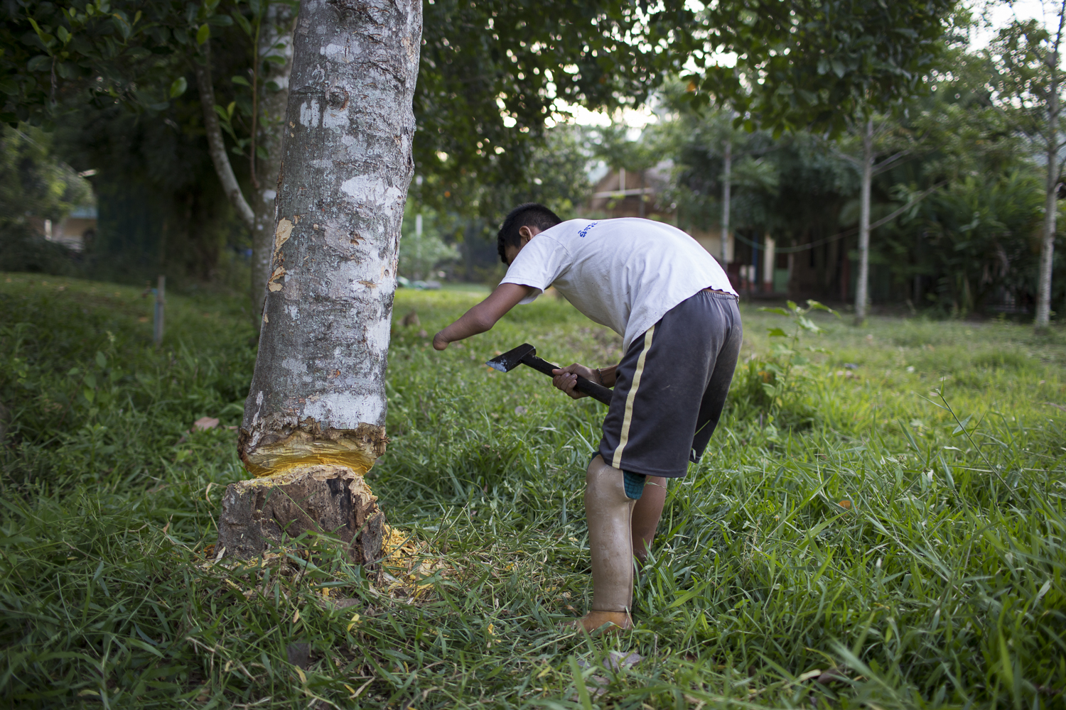 Living with a disability in Cambodia-22.jpg