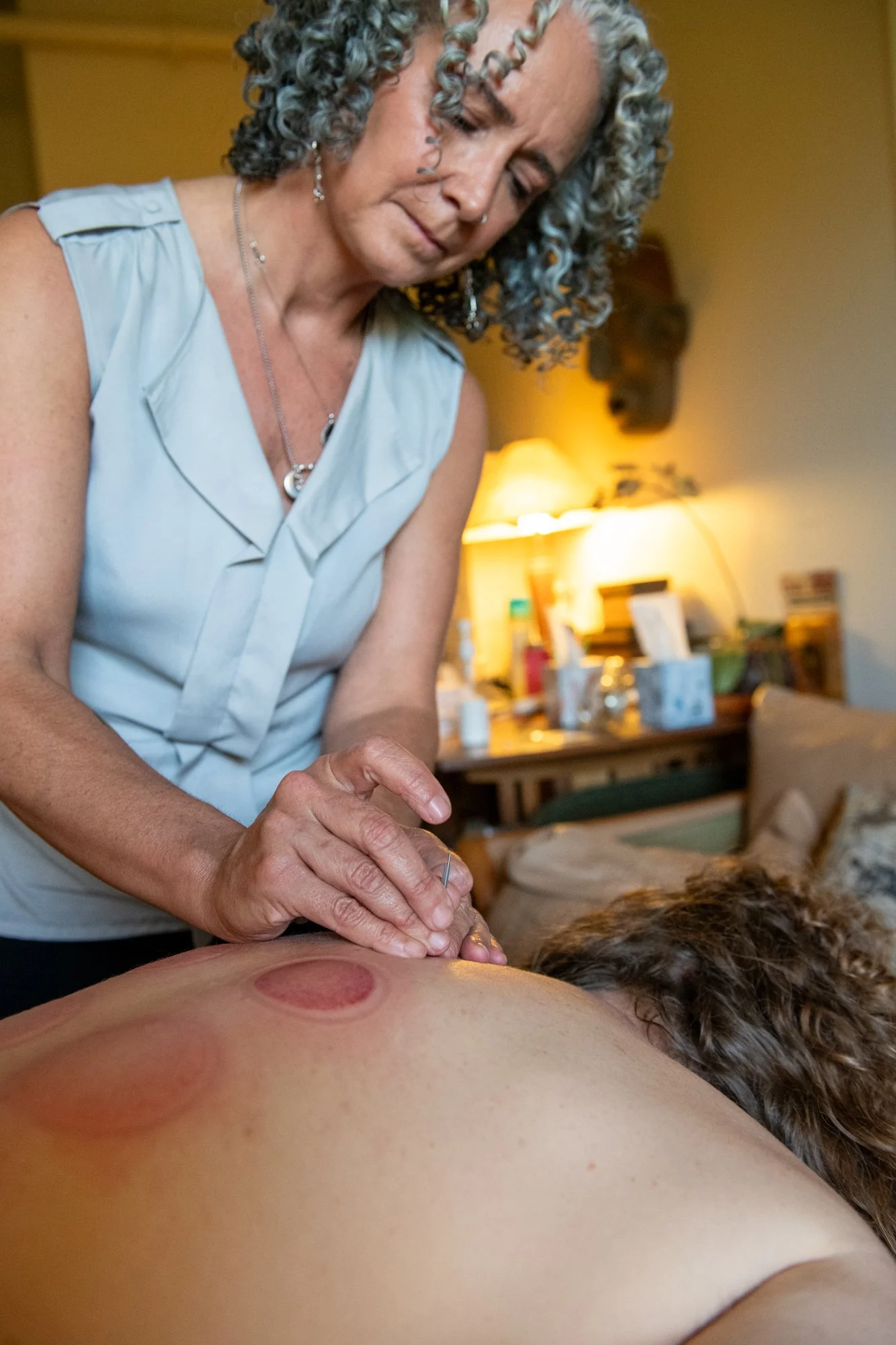 julie-acupuncture-2.jpg