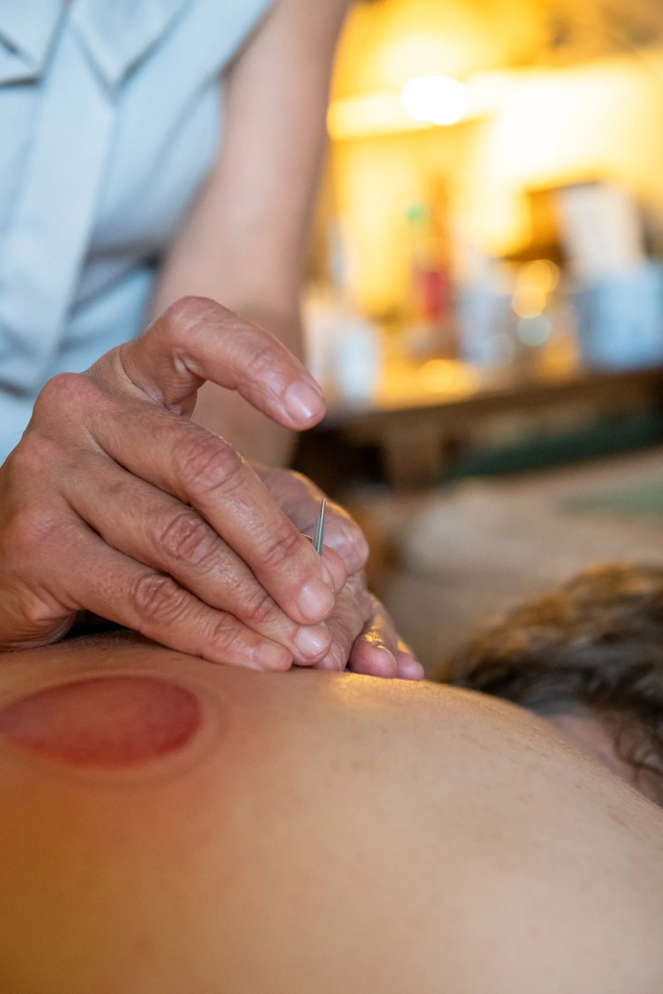 julie-acupuncture-3.jpg