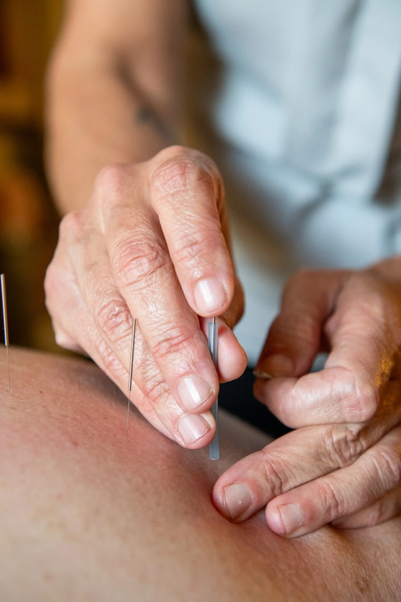 julie-acupuncture-5.jpg